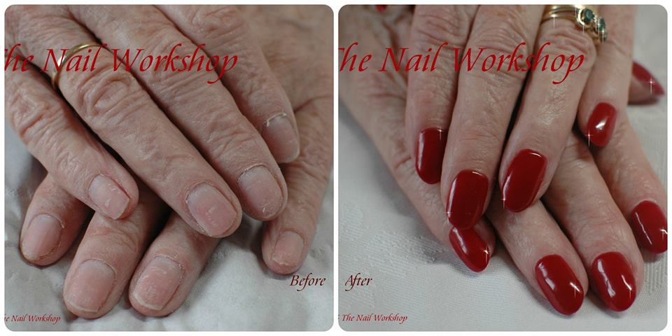  Before and After Acyrlic Sculptured Nails
